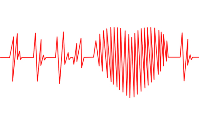 heart trace image